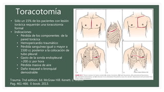 Toracotomía
• Sólo un 15% de los pacientes con lesión
torácica requerirán una toracotomía
formal
• Indicaciones
• Pérdida de los componentes de la
pared torácica
• Hemopericardio traumático
• Pérdida sanguínea igual o mayor a
1500 cc posterior a la colocación de
tubo pleural
• Gasto de la sonda endopleural
>200 cc por hora
• Pérdida masiva de aire
• Daño traqueal o bronquial
demostrable
Trauma. 7nd edition. Ed. McGraw Hill. Kenett. L. Matox.
Pag. 461-466. E-book. 2013.
 