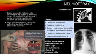 NEUMOTÓRAX
• El aire se puede instalar en la
cavidad pleural desde el exterior a
través de una herida penetrante o
desde el mismo pulmón con
lesiones del árbol bronquial
• ingurgitación yugular, murmullo
pulmonar ausente unilateral,
desviación traqueal.
Incidencia 20%
Dx por:
utilizar en estos casos
catéteres de más de 5
cm de largo
que aumentan la
chance de
descompresión
 