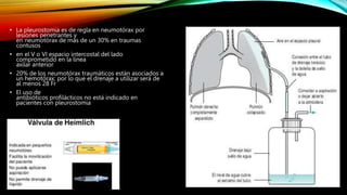 • La pleurostomia es de regla en neumotórax por
lesiones penetrantes y
en neumotórax de más de un 30% en traumas
contusos
• en el V o VI espacio intercostal del lado
comprometido en la línea
axilar anterior
• 20% de los neumotórax traumáticos están asociados a
un hemotórax; por lo que el drenaje a utilizar será de
al menos 28 Fr
• El uso de
antibióticos profilácticos no está indicado en
pacientes con pleurostomia
 