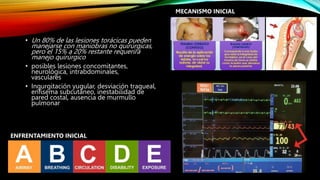 • Un 80% de las lesiones torácicas pueden
manejarse con maniobras no quirúrgicas,
pero el 15% a 20% restante requerirá
manejo quirúrgico
• posibles lesiones concomitantes,
neurológica, intrabdominales,
vasculares
• Ingurgitación yugular, desviación traqueal,
enfisema subcutáneo, inestabilidad de
pared costal, ausencia de murmullo
pulmonar
ENFRENTAMIENTO INICIAL
MECANISMO INICIAL
 