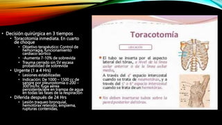 • Decisión quirúrgica en 3 tiempos
• Toracotomía inmediata. En cuarto
de choque
• Objetivo terapéutico: Control de
hemorragia, funcionamiento
cardiaco-aórtico
• -Aumenta 7-10% de sobrevida
• Trauma cerrado sin SV escasa
probabilidad de sobrevida
• Urgente (1 a 4 Hrs)
• Lesiones estabilizadas
• Indicación: De 1000 – 1500 cc de
sangre por pleurostomía o 200 –
300 ml/hr, fuga aérea
persistente/aire en trampa de agua
en todas las fases de la respiración
• Diferida después de 24 Hrs
• Lesión traqueo bronquial,
hemotórax retenido, empiema,
rupturas contenidas,
 