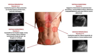 • Rx Tórax y FAST abdominal
 