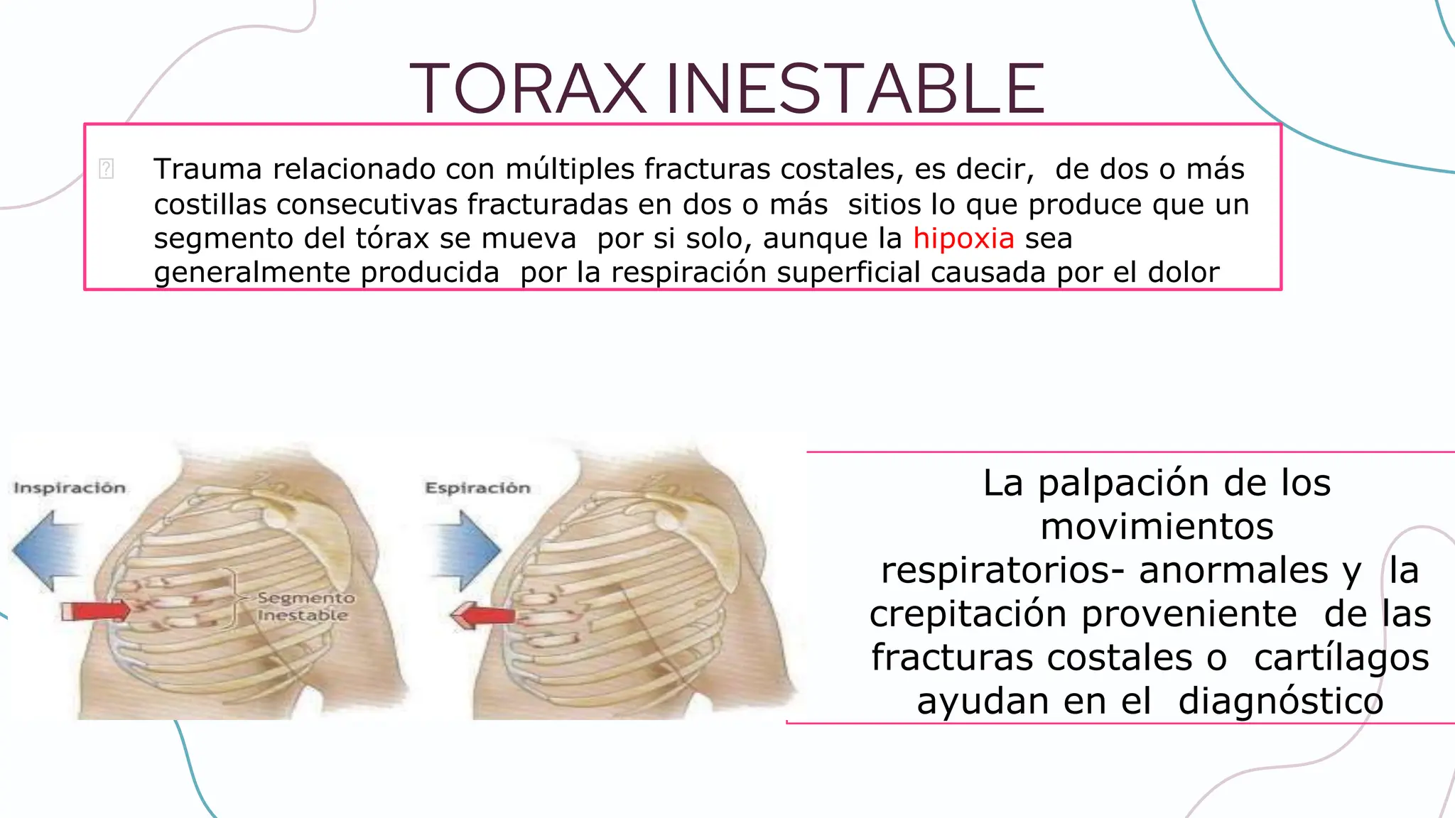 Trauma de tórax PARA EL SERVICIO DE URGENCIAS | PPTX
