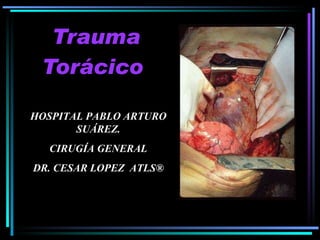 Trauma Torácico   HOSPITAL PABLO ARTURO SUÁREZ. CIRUGÍA GENERAL DR. CESAR LOPEZ  ATLS® 