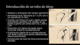 Introducción de un tubo de tórax
• Asepsia y antisepsia del campo operatorio
• Anestesia local: Xilocaína al 1 o 2% con o
sin epinefrina, 5-10cc
• Incisión con bisturí en piel y tejido celular
subcutáneo paralela a la costilla, en su
borde superior por arriba del 5 EI, LAM o
LAA
• Disección con tijeras de tejido plano
muscular hasta la cavidad pleural
• Exploración digital de la cavidad pleural
con dedo índice para excluir adherencias
pleuro-pulmonares
• Introducción de tubo de tórax previamente
pinzado
 