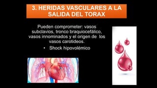 3. HERIDAS VASCULARES A LA
SALIDA DEL TORAX
Pueden comprometer: vasos
subclavios, tronco braquiocefálico,
vasos innominados y el origen de los
vasos carotideos.
• Shock hipovolémico
 