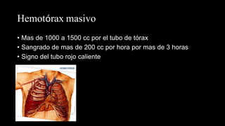 Hemotórax masivo
• Mas de 1000 a 1500 cc por el tubo de tórax
• Sangrado de mas de 200 cc por hora por mas de 3 horas
• Signo del tubo rojo caliente
 