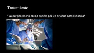 Tratamiento
• Quirurgico hecho en los posible por un cirujano cardiovascular
 