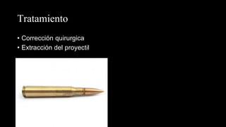 Tratamiento
• Corrección quirurgica
• Extracción del proyectil
 