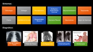 Odinofagia Disfagia Hematemesis
Enfisema
Subcutaneo
Cervical
Neumomediastino Taquicardia
Fiebre Cambios en la voz
Epigastralgia
Severa
Derrame Pleural Neumotorax Signo de Hamman
Síntomas:
Rx de Cuello o
Tórax
Tubo de Tórax Esofagograma Cinerradiografia Endoscopia
Diagnótico:
 