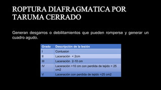 ROPTURA DIAFRAGMATICA POR
TARUMA CERRADO
Generan desgarros o debilitamientos que pueden romperse y generar un
cuadro agudo.
Grado Descripción de la lesión
I Contusion
II Laceración < 2cm
III Laceración 2-10 cm
IV Laceración >10 cm con perdida de tejido < 25
cm2
V Laceración con perdida de tejido >25 cm2
 