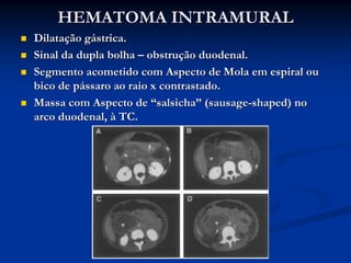 HEMATOMA INTRAMURAL
Dilatação gástrica.
Sinal da dupla bolha – obstrução duodenal.
Segmento acometido com Aspecto de Mola em espiral ou
bico de pássaro ao raio x contrastado.
Massa com Aspecto de “salsicha” (sausage-shaped) no
arco duodenal, à TC.
 