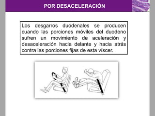 POR DESACELERACIÓN
Los desgarros duodenales se producen
cuando las porciones móviles del duodeno
sufren un movimiento de aceleración y
desaceleración hacia delante y hacia atrás
contra las porciones fijas de esta víscer.
 