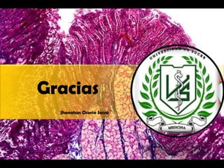 Gracias
Jhonatan Osorio Sossa
 