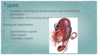 Trauma during labor Razi mohammadaxy.pptx