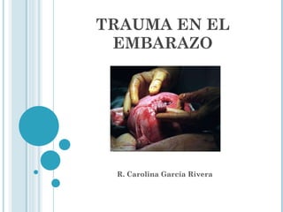 TRAUMA EN EL EMBARAZO R. Carolina García Rivera 