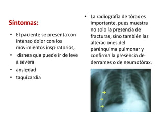 Síntomas:
• El paciente se presenta con
intenso dolor con los
movimientos inspiratorios,
• disnea que puede ir de leve
a severa
• ansiedad
• taquicardia
• La radiografía de tórax es
importante, pues muestra
no solo la presencia de
fracturas, sino también las
alteraciones del
parénquima pulmonar y
confirma la presencia de
derrames o de neumotórax.
 
