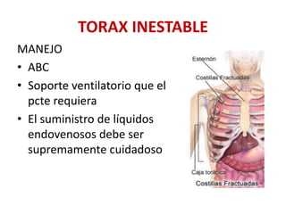 TORAX INESTABLE
MANEJO
• ABC
• Soporte ventilatorio que el
pcte requiera
• El suministro de líquidos
endovenosos debe ser
supremamente cuidadoso
 