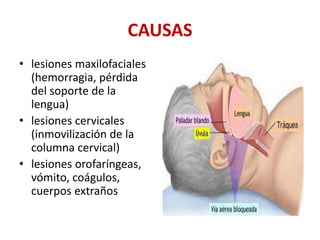 CAUSAS
• lesiones maxilofaciales
(hemorragia, pérdida
del soporte de la
lengua)
• lesiones cervicales
(inmovilización de la
columna cervical)
• lesiones orofaríngeas,
vómito, coágulos,
cuerpos extraños
 