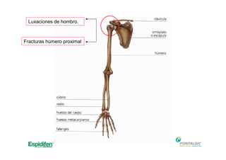 Luxaciones de hombro.
Fracturas húmero proximal
 