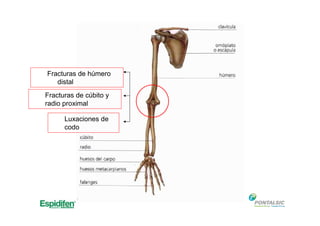Fracturas de húmero
distal
Fracturas de cúbito y
radio proximal
Luxaciones de
codo
 