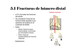 5.1 Fracturas de húmero distal
• 0.5 % de todas las fracturas
del adulto.
• Se consideran fracturas de
húmero distal aquellas cuyo
epicentro se localiza en el
cuadrado de Muller.
• Edad:
– Adulto: fracturas supra-
intercondileas, conminutas
por traumatismo directo.
– Niños: fracturas
supracondileas por traumas
indirectos
Clasificación:
Arteria humeral
 