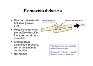 Pronación dolorosa
• Más frec. en niñas de
2-3 años (raro en
>5ª)
• Mecanismo lesional:
pronación y tracción
forzadas con el brazo
extendido.
• Clínica: brazo
extendido y pronado,
con el antecedente
de tracción.
• Rx: normal.
Trto: Invertir los movimientos
que lo han causado:
Supinación + flexión + presión
sobre la cabeza del radio
 
