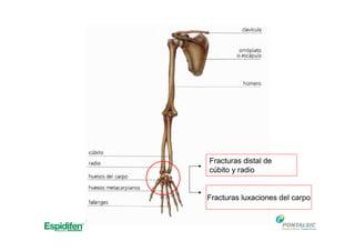 Fracturas distal de
cúbito y radio
Fracturas luxaciones del carpo
 