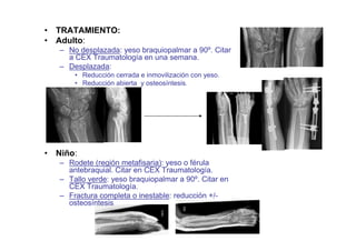 • TRATAMIENTO:
• Adulto:
– No desplazada: yeso braquiopalmar a 90º. Citar
a CEX Traumatología en una semana.
– Desplazada:
• Reducción cerrada e inmovilización con yeso.
• Reducción abierta y osteosíntesis.
• Niño:
– Rodete (región metafisaria): yeso o férula
antebraquial. Citar en CEX Traumatología.
– Tallo verde: yeso braquiopalmar a 90º. Citar en
CEX Traumatología.
– Fractura completa o inestable: reducción +/-
osteosíntesis
 
