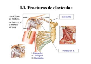 1.1. Fracturas de clavícula :
Cabestrillo
Vendaje en 8.
I: Cabestrillo.
II: Quirúrgico.
III: Cabestrillo.
-2.4-10% de
las fracturas.
- sobre todo en
la infancia,
varones
70-80%
25-30%
2%
 