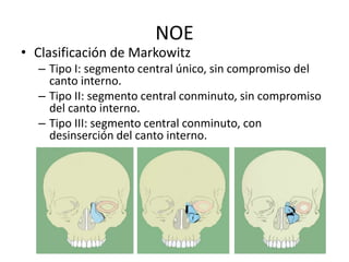 NOE
• Clasificación de Markowitz
– Tipo I: segmento central único, sin compromiso del
canto interno.
– Tipo II: segmento central conminuto, sin compromiso
del canto interno.
– Tipo III: segmento central conminuto, con
desinserción del canto interno.
 