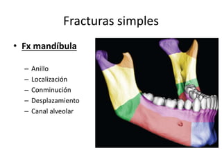 Fracturas simples
• Fx mandíbula
– Anillo
– Localización
– Conminución
– Desplazamiento
– Canal alveolar
 