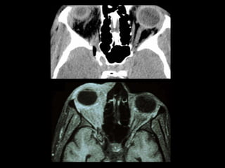 Traumatismos faciales