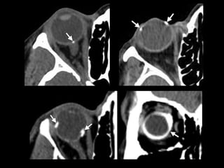 Traumatismos faciales