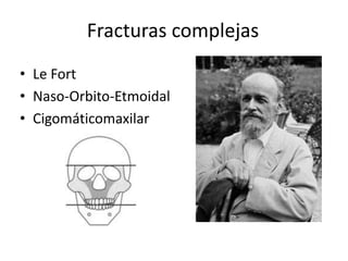 Fracturas complejas
• Le Fort
• Naso-Orbito-Etmoidal
• Cigomáticomaxilar
 