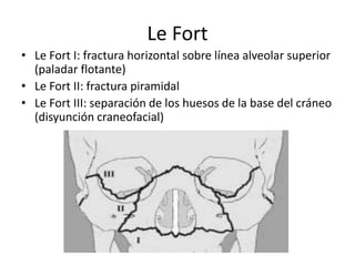 Le Fort
• Le Fort I: fractura horizontal sobre línea alveolar superior
(paladar flotante)
• Le Fort II: fractura piramidal
• Le Fort III: separación de los huesos de la base del cráneo
(disyunción craneofacial)
 