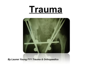 Trauma By Lauren Young FY1 Trauma & Orthopaedics 