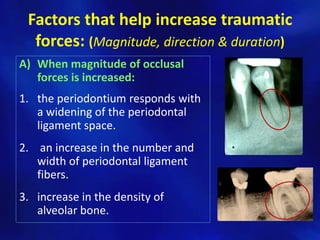 Factors that help increase traumatic
  forces: (Magnitude, direction & duration)
A) When magnitude of occlusal
   forces is increased:
1. the periodontium responds with
   a widening of the periodontal
   ligament space.
2. an increase in the number and
   width of periodontal ligament
   fibers.
3. increase in the density of
   alveolar bone.
 