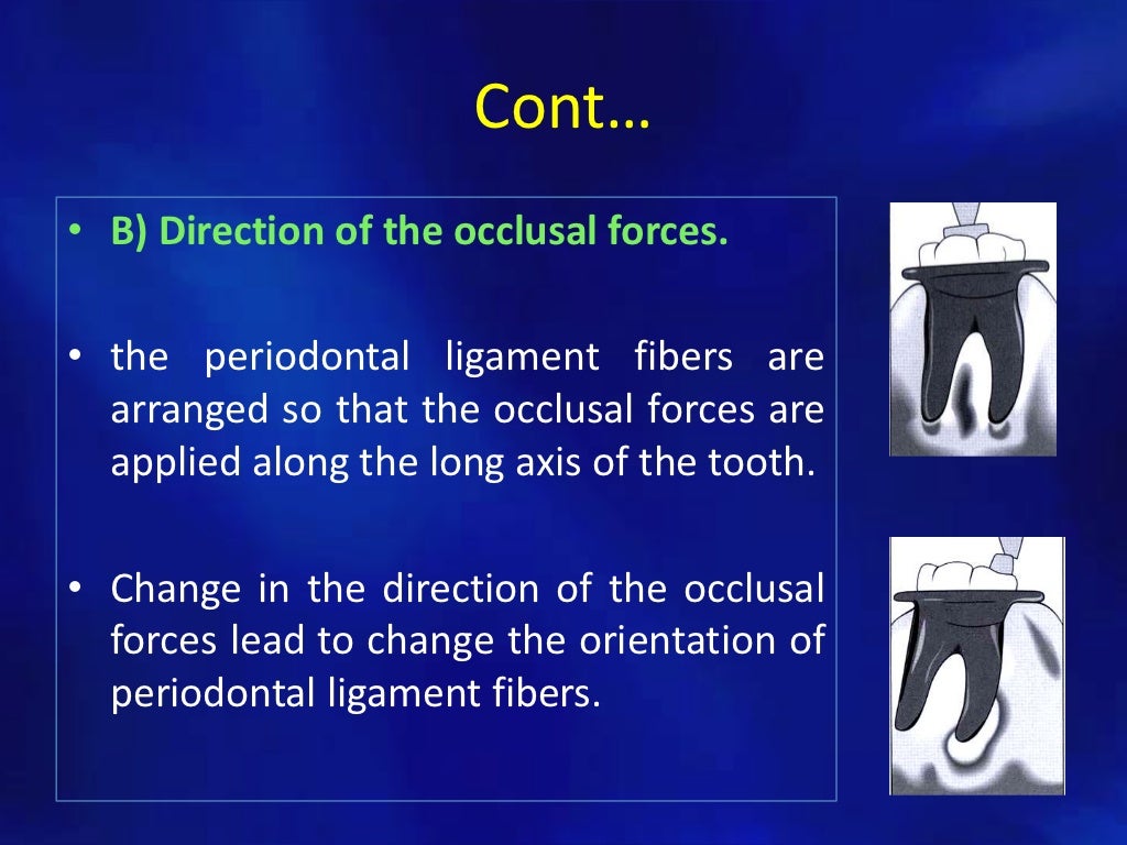 Trauma from occlusion