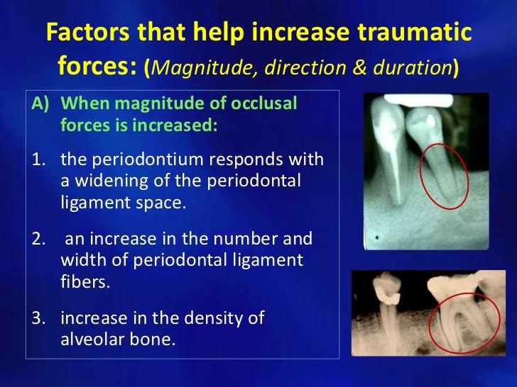 Trauma from occlusion
