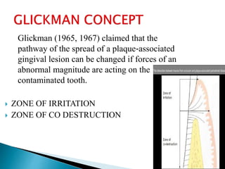 Glickman (1965, 1967) claimed that the
pathway of the spread of a plaque‐associated
gingival lesion can be changed if forces of an
abnormal magnitude are acting on the
contaminated tooth.
 ZONE OF IRRITATION
 ZONE OF CO DESTRUCTION
1
4
/
3
1
 