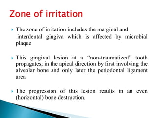  The zone of irritation includes the marginal and
interdental gingiva which is affected by microbial
plaque
 This gingival lesion at a “non‐traumatized” tooth
propagates, in the apical direction by first involving the
alveolar bone and only later the periodontal ligament
area
 The progression of this lesion results in an even
(horizontal) bone destruction.
 