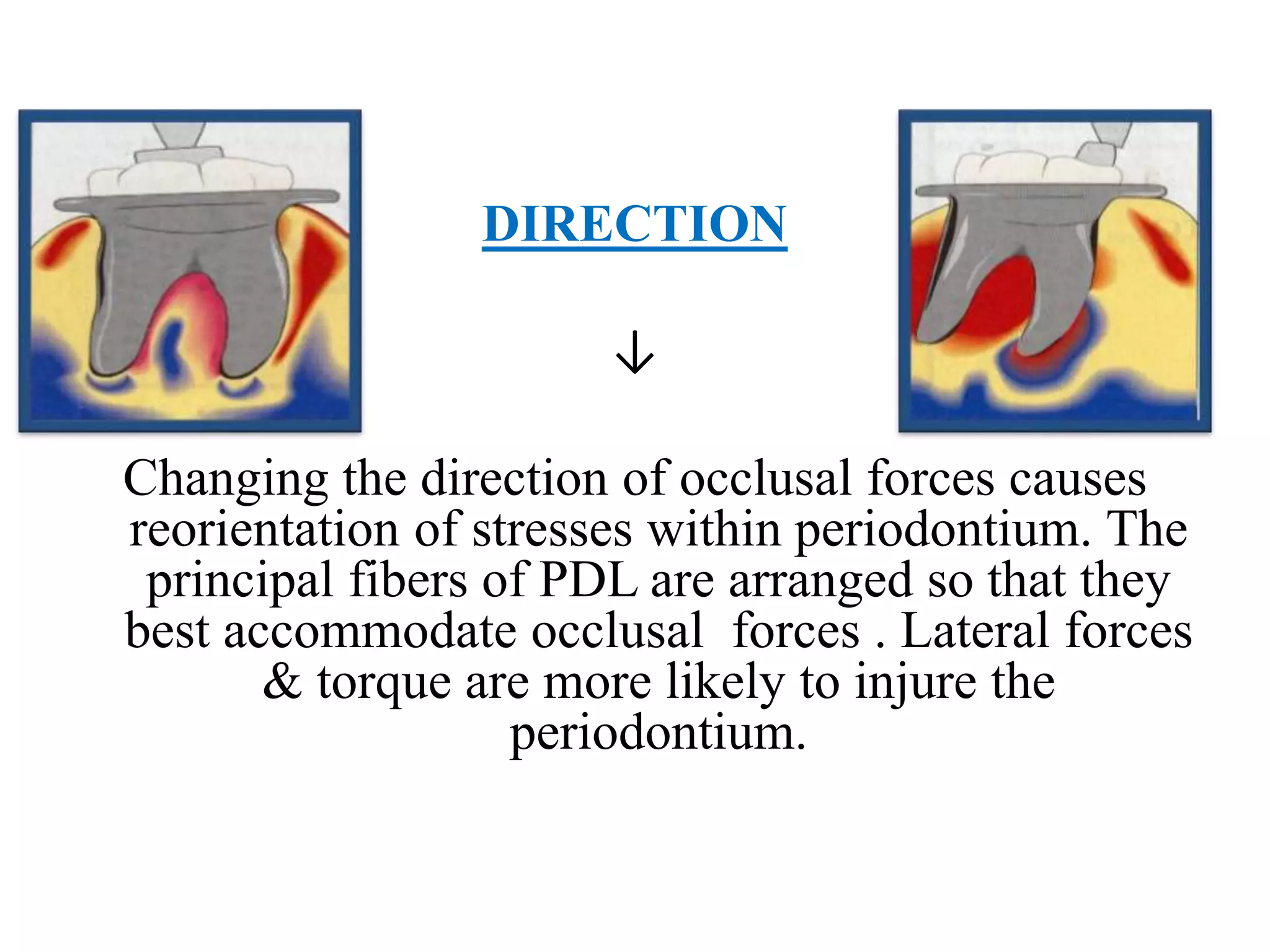 Trauma from occlusion
