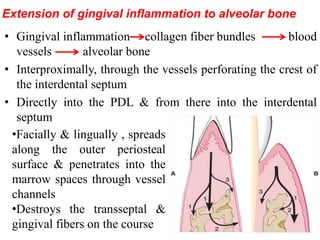 Extension of gingival inflammation to alveolar bone
• Gingival inflammation collagen fiber bundles blood
vessels alveolar bone
• Interproximally, through the vessels perforating the crest of
the interdental septum
• Directly into the PDL & from there into the interdental
septum
•Facially & lingually , spreads
along the outer periosteal
surface & penetrates into the
marrow spaces through vessel
channels
•Destroys the transseptal &
gingival fibers on the course
 
