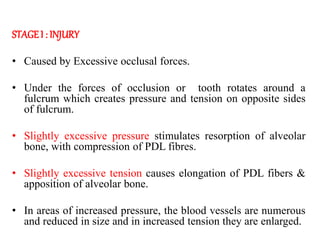 STAGEI : INJURY
• Caused by Excessive occlusal forces.
• Under the forces of occlusion or tooth rotates around a
fulcrum which creates pressure and tension on opposite sides
of fulcrum.
• Slightly excessive pressure stimulates resorption of alveolar
bone, with compression of PDL fibres.
• Slightly excessive tension causes elongation of PDL fibers &
apposition of alveolar bone.
• In areas of increased pressure, the blood vessels are numerous
and reduced in size and in increased tension they are enlarged.
 