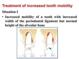 Treatment of increased tooth mobility
Situation I
• Increased mobility of a tooth with increased
width of the periodontal ligament but normal
height of the alveolar bone
 
