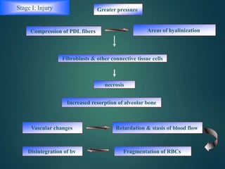 Greater pressure
Compression of PDL fibers Areas of hyalinization
Fibroblasts & other connective tissue cells
necrosis
Vascular changes Retardation & stasis of blood flow
Fragmentation of RBCsDisintegration of bv
Increased resorption of alveolar bone
Stage I: Injury
 