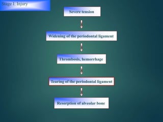 Stage I: Injury
Widening of the periodontal ligament
Tearing of the periodontal ligament
Severe tension
Thrombosis, hemorrhage
Resorption of alveolar bone
 
