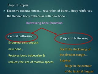 Stage II: Repair
 Excessive occlusal forces…. resorption of bone…. Body reinforces
the thinned bony trabeculae with new bone…
Buttressing bone formation
Central buttressing
Endosteal cells deposit
new bone ,
Restores bony trabeculae &
reduces the size of marrow spaces
Peripheral buttressing
Shelf like thickening of
the alveolar margin…
Lipping/
Bulge in the contour
of the facial & lingual
 