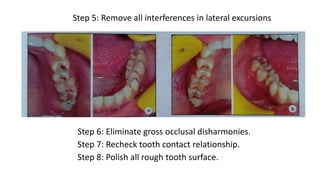 Lateral Excursion Interferences Trauma from occlusion in Periodontics.pptx